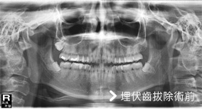 基隆牙醫、基隆牙醫價錢、基隆 植牙、基隆 矯正 推薦、基隆矯正推薦、基隆植牙