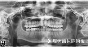 基隆牙醫、基隆牙醫價錢、基隆 植牙、基隆 矯正 推薦、基隆矯正推薦、基隆植牙