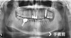 基隆牙醫、基隆牙醫價錢、基隆 植牙、基隆 矯正 推薦、基隆矯正推薦、基隆植牙