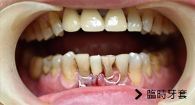 基隆牙醫、基隆牙醫價錢、基隆 植牙、基隆 矯正 推薦、基隆矯正推薦、基隆植牙