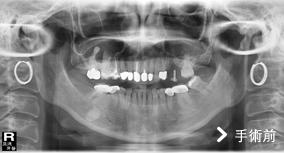 基隆牙醫、基隆牙醫價錢、基隆 植牙、基隆 矯正 推薦、基隆矯正推薦、基隆植牙